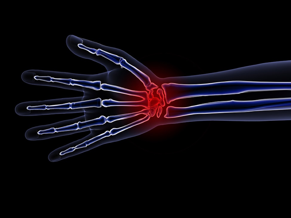 Carpal Tunnel Syndrome: a series of instructions for hand stretches dental professionals can do to prevent carpal tunnel.