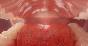 Rolul igienei orale în prevenirea afecţiunilor dentare şi ale mucoasei orale